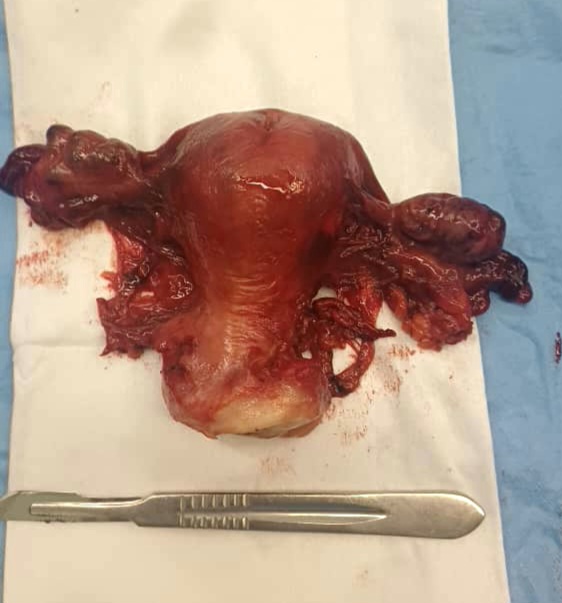 سرطان دهانه رحم - دکتر مریم معتمدی‌نسب